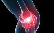 Arthritis knee banner thumbnail