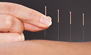 Acupuncture thumbnail