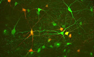 Cellular and Molecular Neuroscience (CMN) identifier