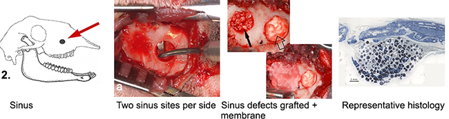 BBOI sinus defects model