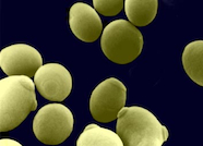 Scanning electron microscopy image of Candida albicans yeast cells