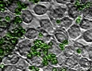 Fluorescence microscopy image of Candida albicans cells (green) adhering to human tissue culture cells