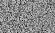 Scanning electron microscope image of moa eggshell thumb