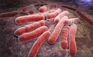 Bacterial infection tuberculosis thumbnail